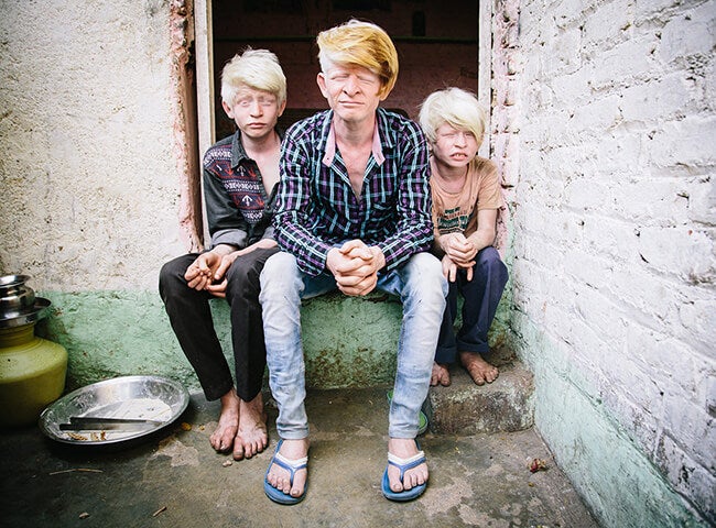 Three albinos
